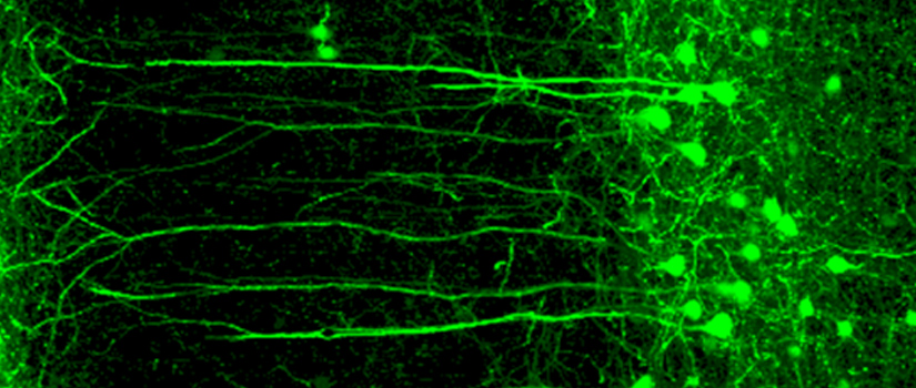 Fluorescent microscopy image of neurons, showing green-stained neural pathways and cell bodies extending across a dark background.