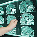 images of brain from an mri